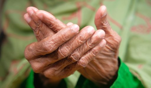 Ízületeink védelmében – Hogyan előzhető meg az arthritis?